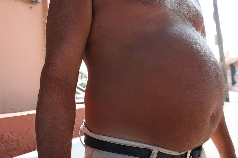 An obese man's belly