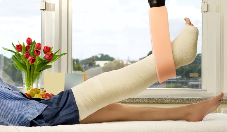 Leg in a cast and elevated in hospital bed