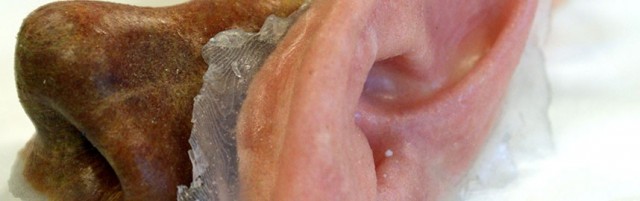 Fripp Design 3-D Printed Nose and Ear