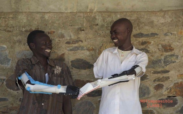 Not Impossible Labs Project Daniel 3-D Printed Arm