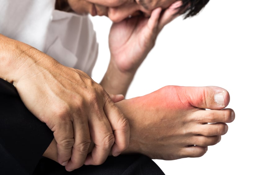 A man dealing with swollen body parts