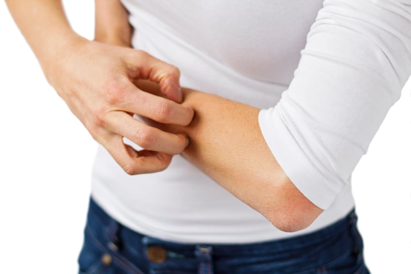 itching skin