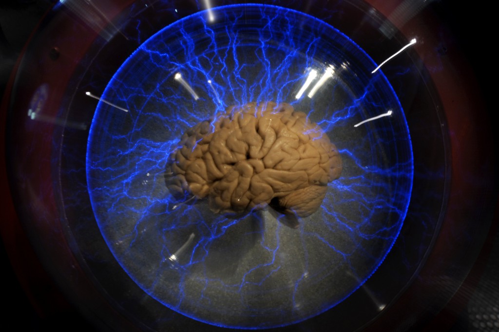 An actual human brain 