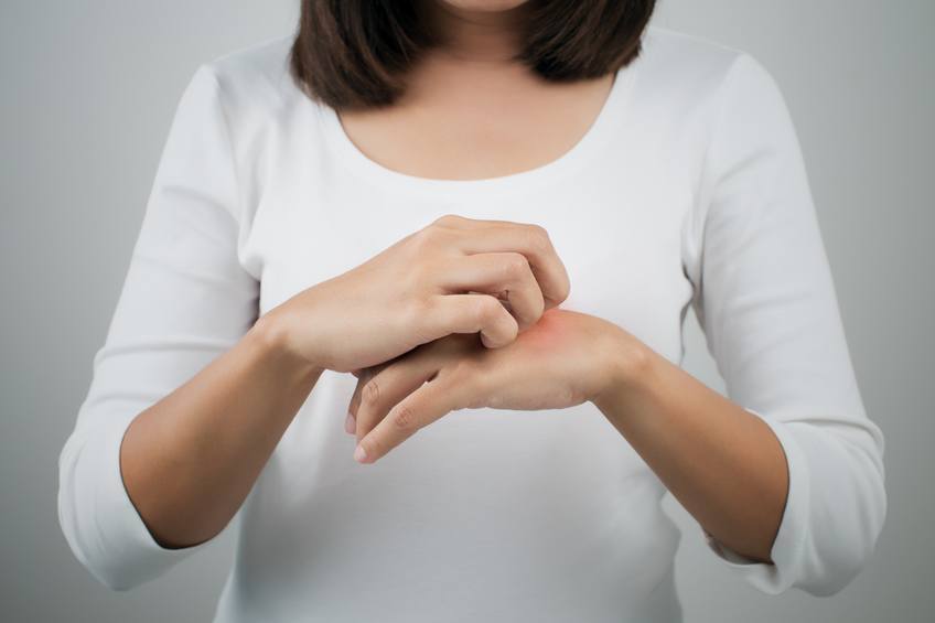 A woman with skin problems
