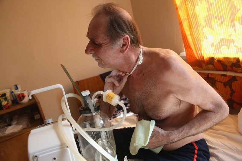 A man looks into a small mirror to adjust the opening to his throat from a tracheotomy A man looks into a small mirror to adjust the opening to his throat from a tracheotomy