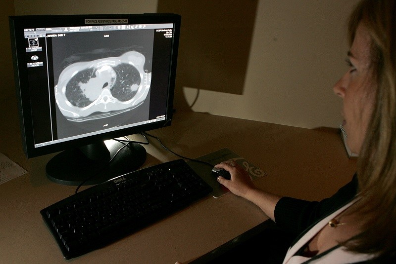 Radiology technologist looks at a CT scan of a tumor