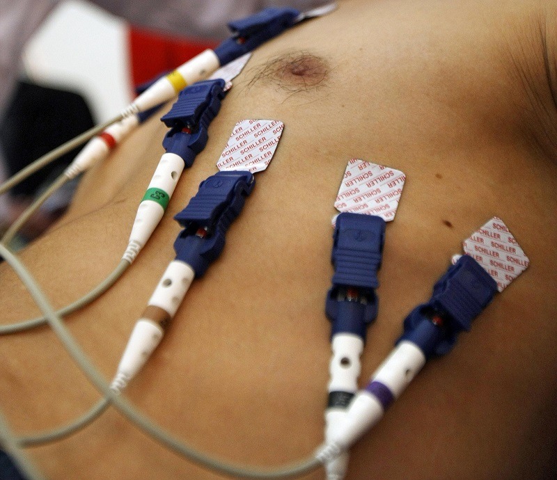 Electrodes on a man's chest