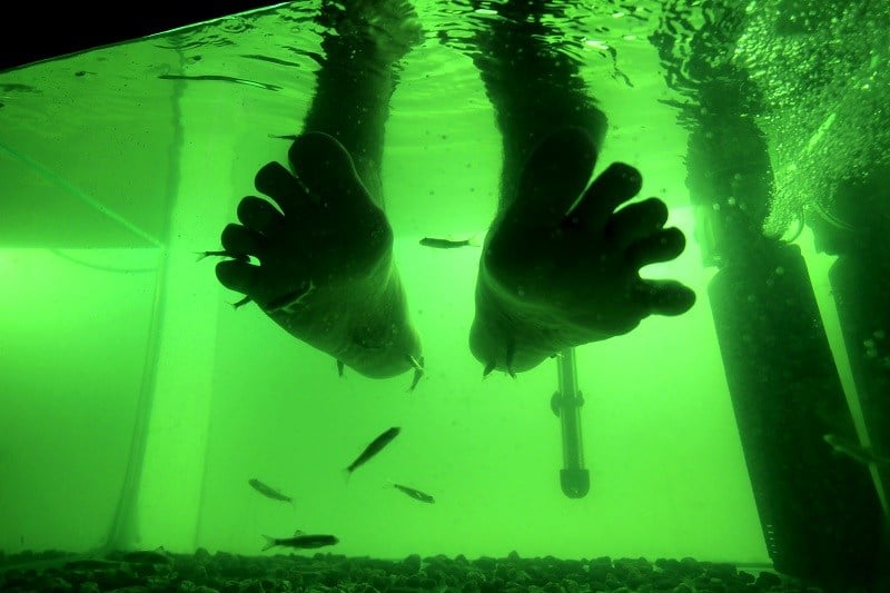A patient uses an alternative method to treat Psoriasis -- fish A patient uses an alternative method to treat Psoriasis -- fish