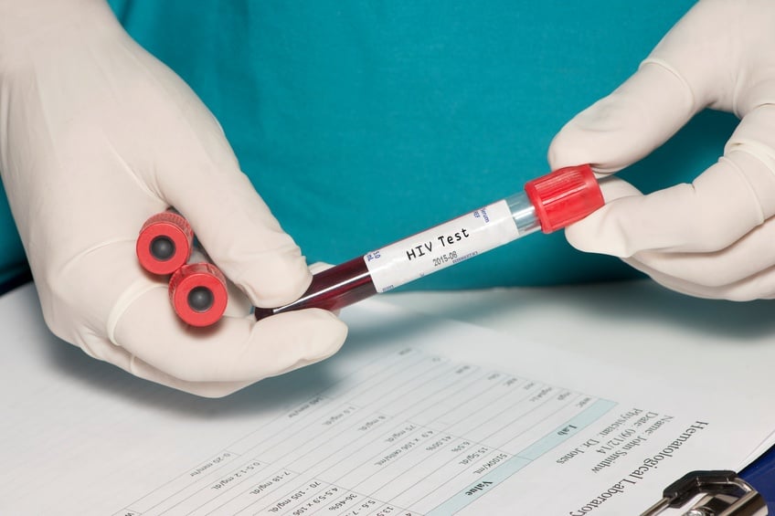 Blood collection tube with HIV test label