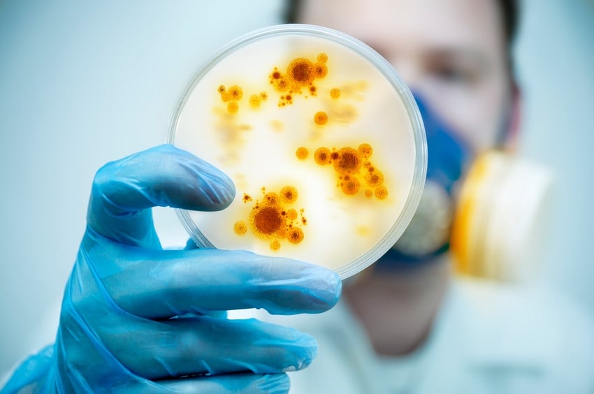 Scientist analyzing dish with virus and bacteria cells
