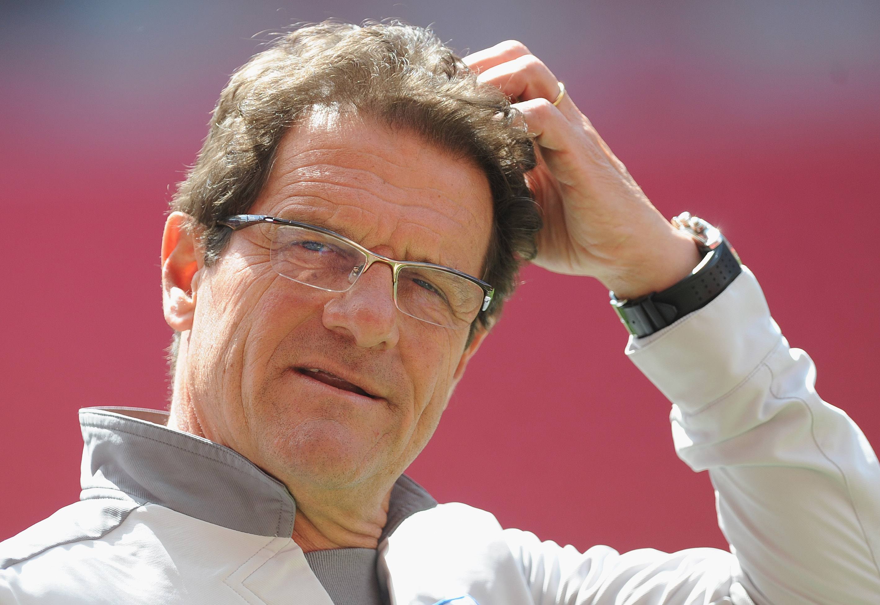 England manager Fabio Capello scratches his head England manager Fabio Capello scratches his head