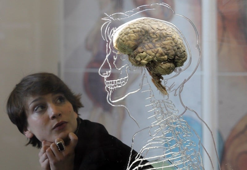 Nicole Briggs looks at a real human brain being displayed as part of new exhibition