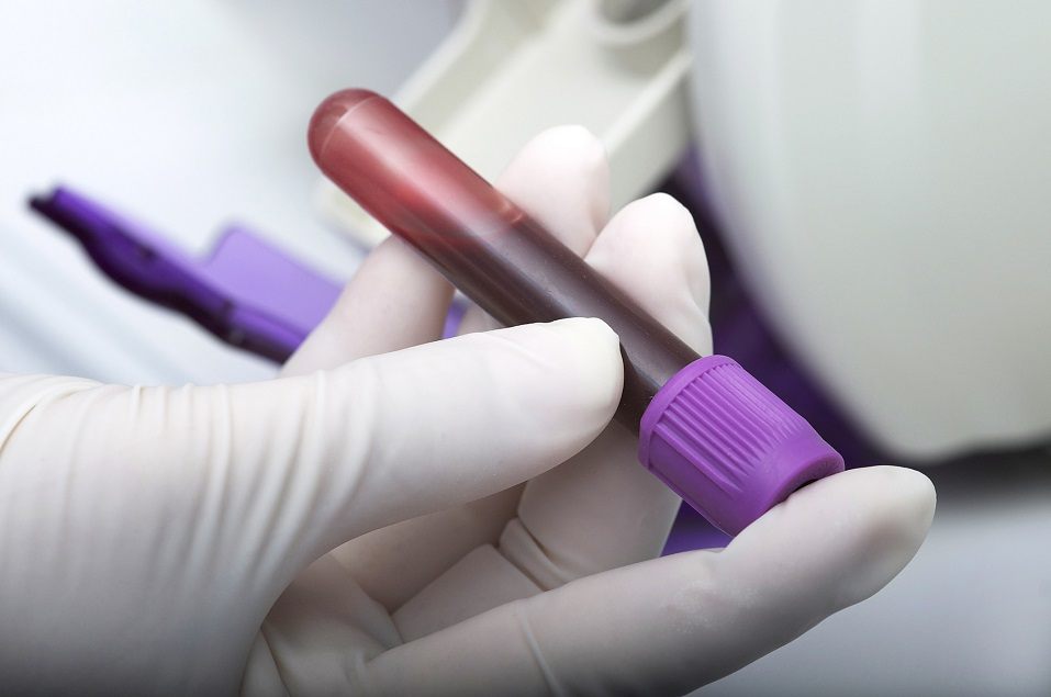blood sample