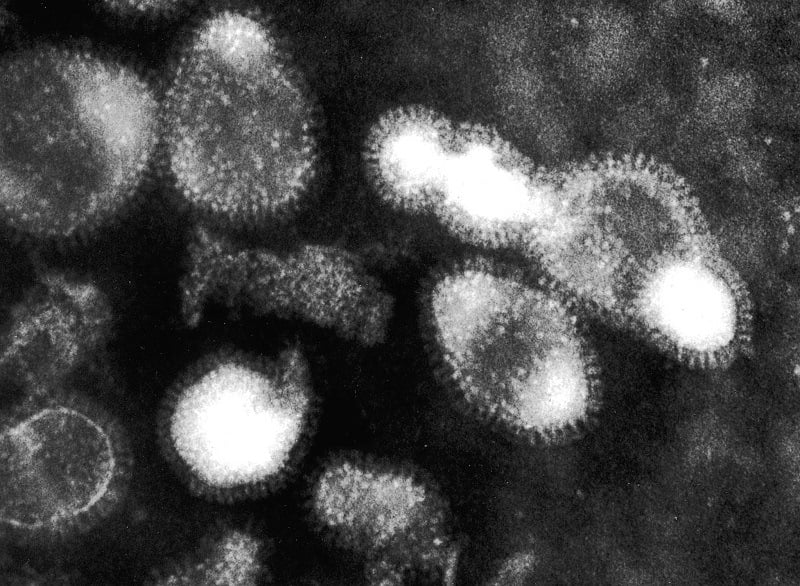 A photo of the H5N1 or "bird flu" virus as seen through a microscope