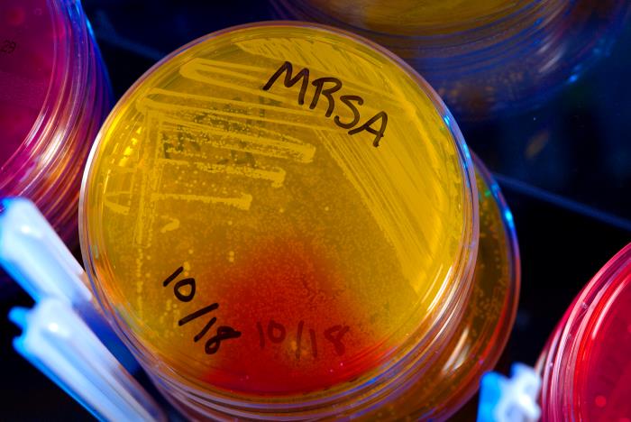 Staphylococcus aureus, or MRSA, in a petri dish. Staphylococcus aureus, or MRSA, in a petri dish.