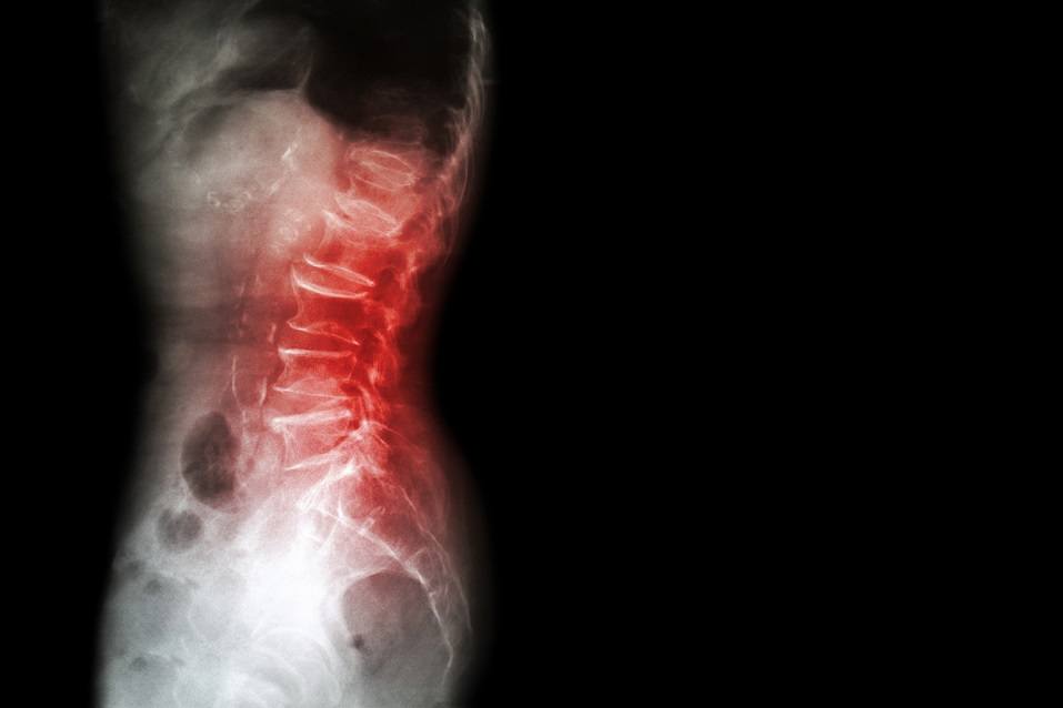 sacral spine show spine sacral spine show spine