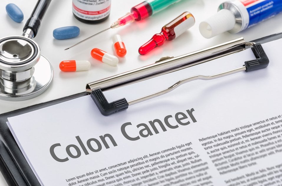 The diagnosis Colon Cancer written on a clipboard