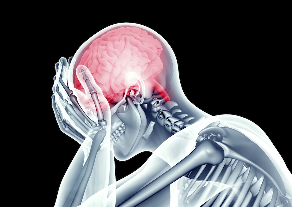 human head with headache pain