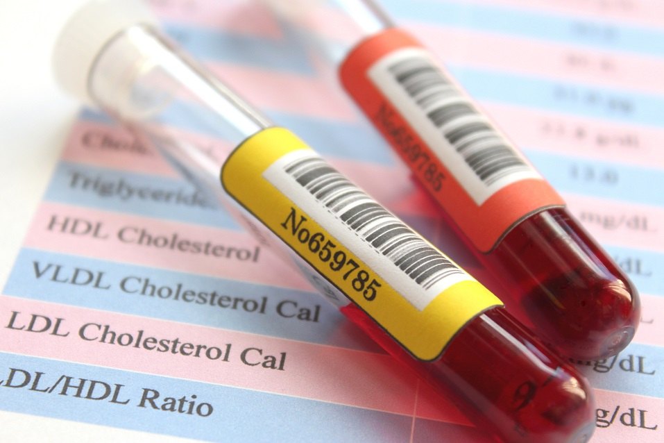 sample of blood collection
