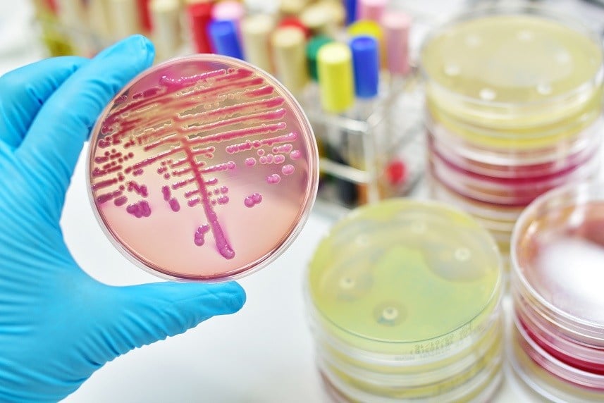 bacteria in culture medium plate