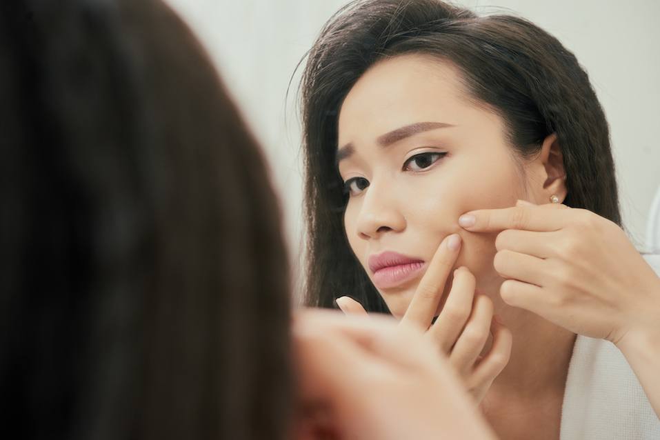 Young woman popping pimple on her cheeck