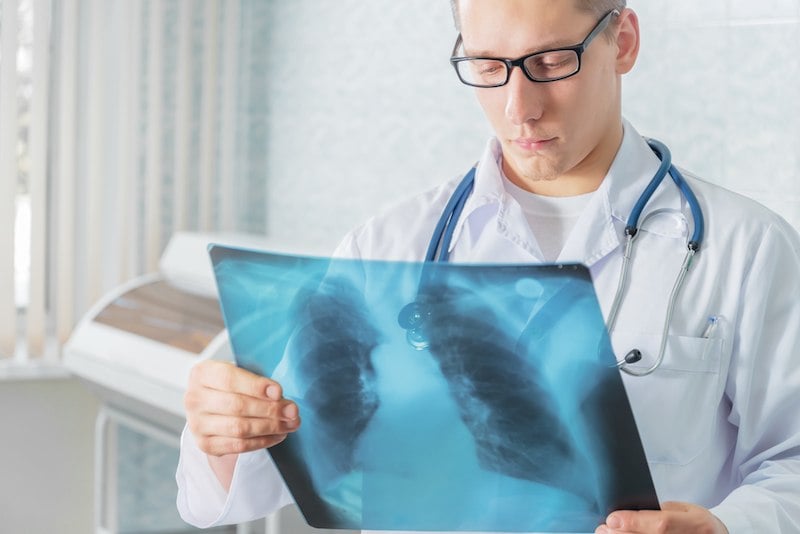 doctor looking at X-ray