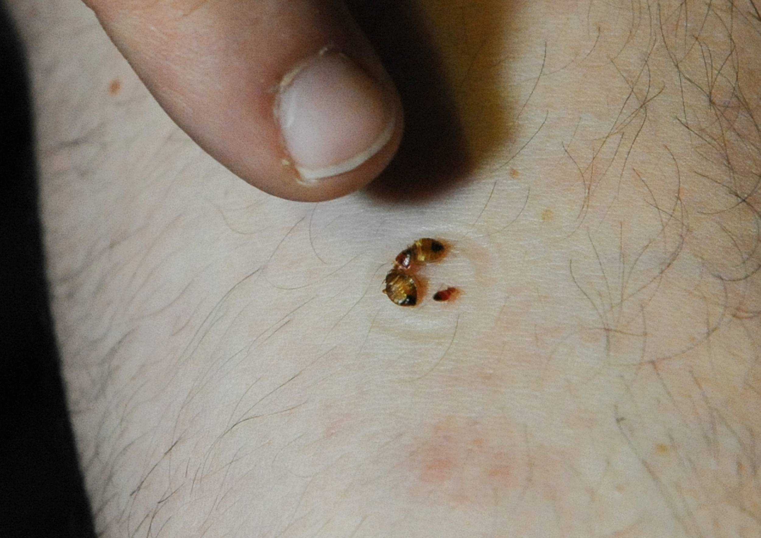 punaises bedbugs chinches bites prennent getting bitten assaut ecosdemiciudad habitada envahir culot cheatsheet