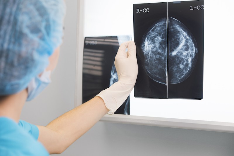 Nurse holding an X ray Nurse holding an X ray