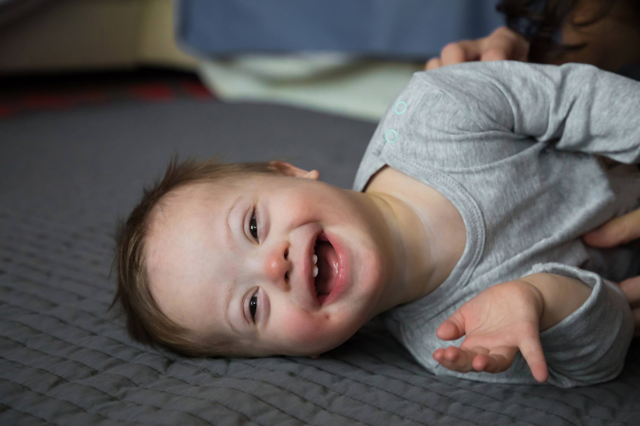 This Adorable 18-Month Old Baby With Down Syndrome Just ...