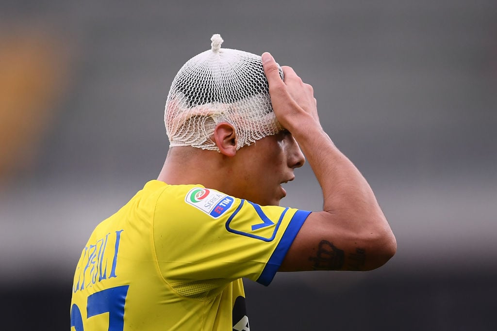 Chievo defender's Fabio Depaoli touches his head after an injury