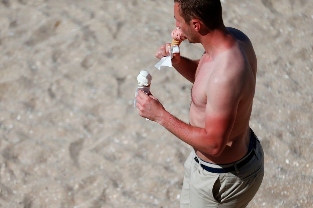 A man with sunburns