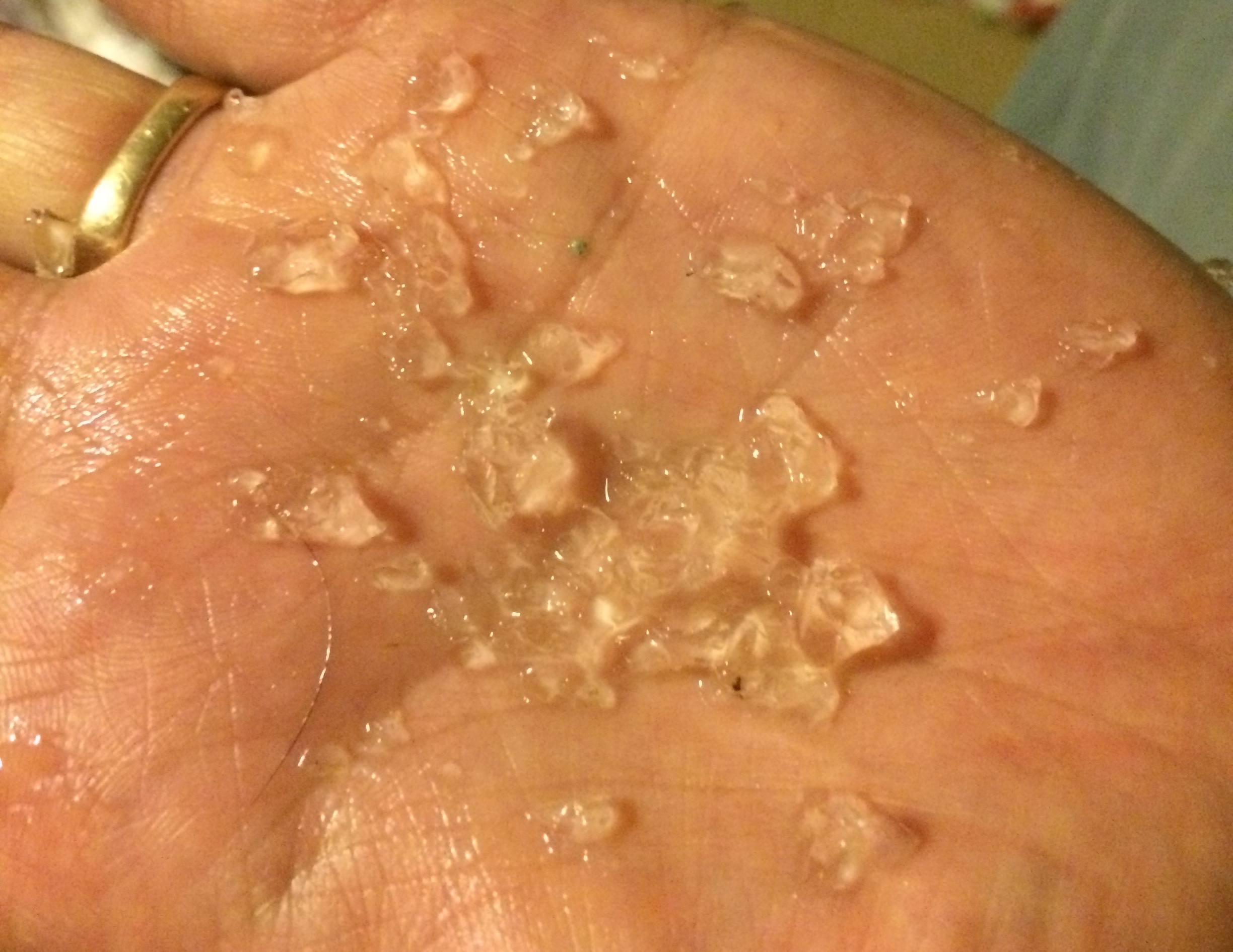 Rain jelly