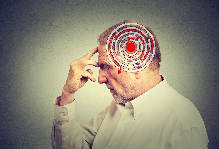 Memoryloss Memoryloss