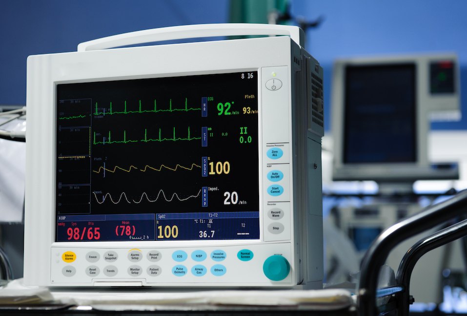 Anesthesia monitor