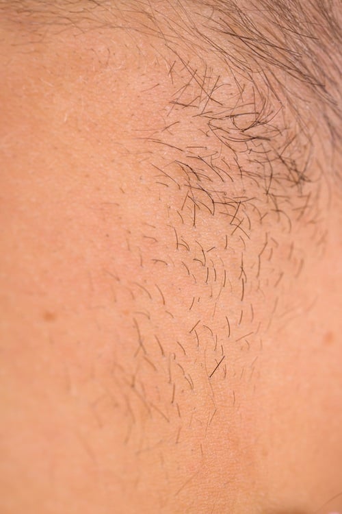 Body hair. Body hair.