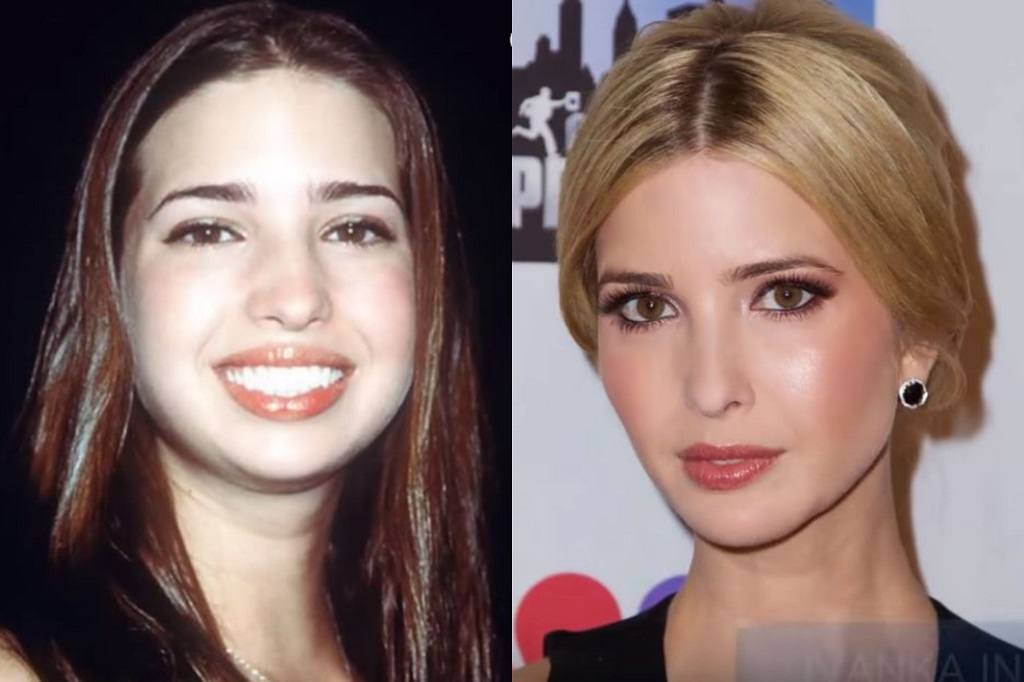 Ivanka as a young teen and in 2015