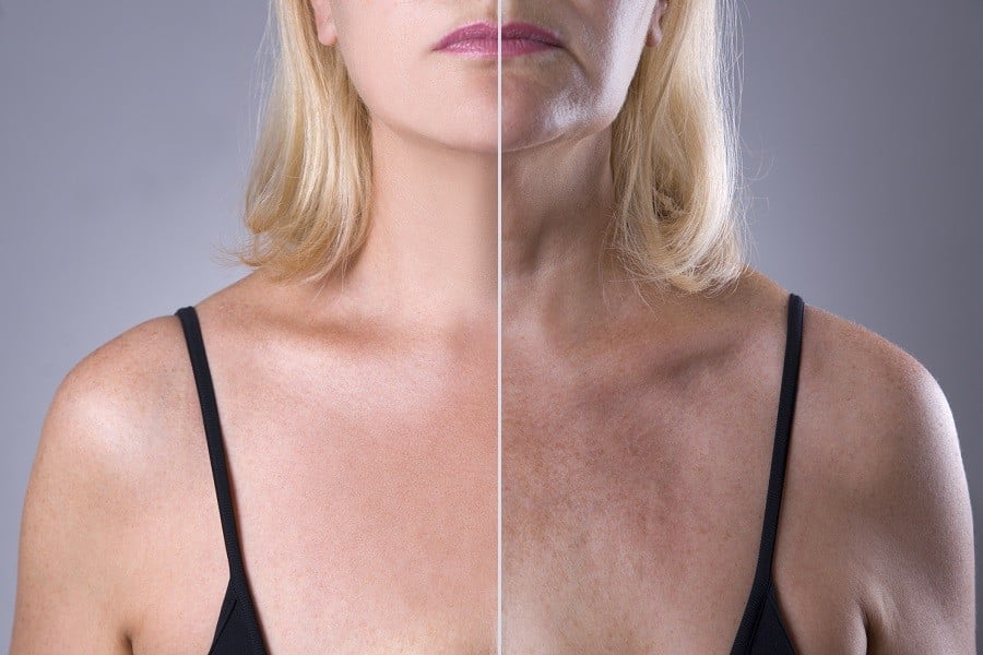 Change in skin