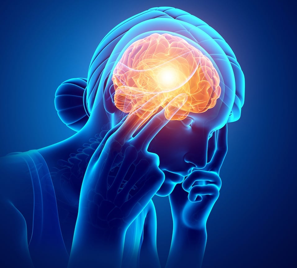 Migraine pain