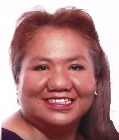 Tracy Garcia, the woman mauled by dachshunds Tracy Garcia, the woman mauled by dachshunds