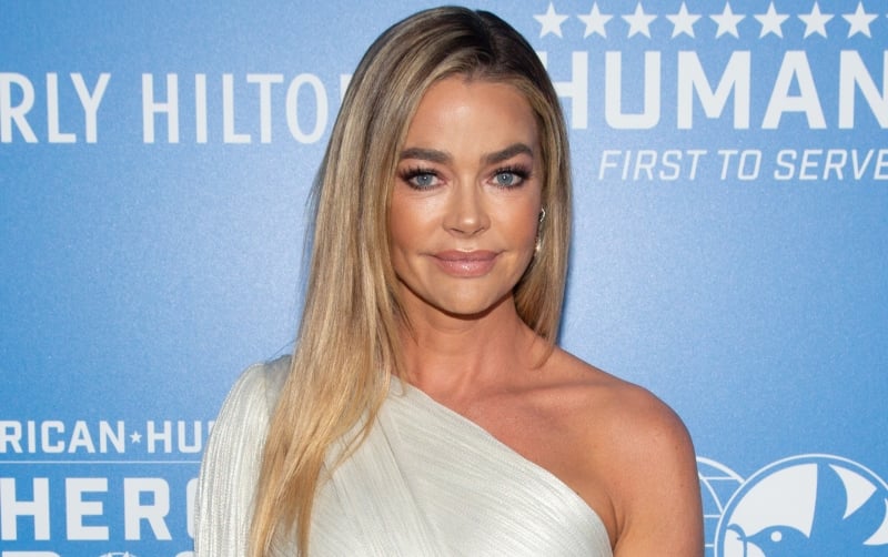 RHOBH': Did Denise Richards Ever Get Plastic Surgery?