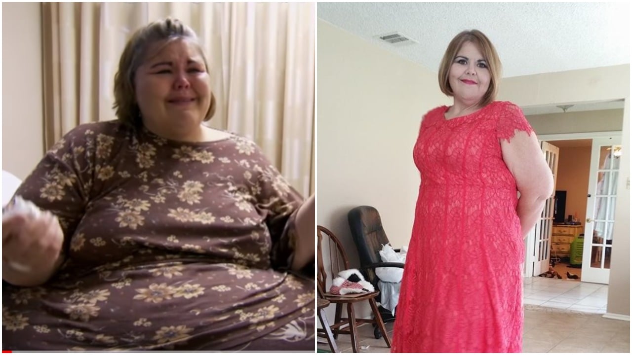 The before and after photos on the TLC show 'My 600-Lb. 