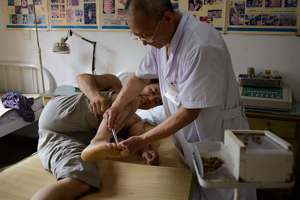 Doctor of traditional Chinese medicine administers a beesting.