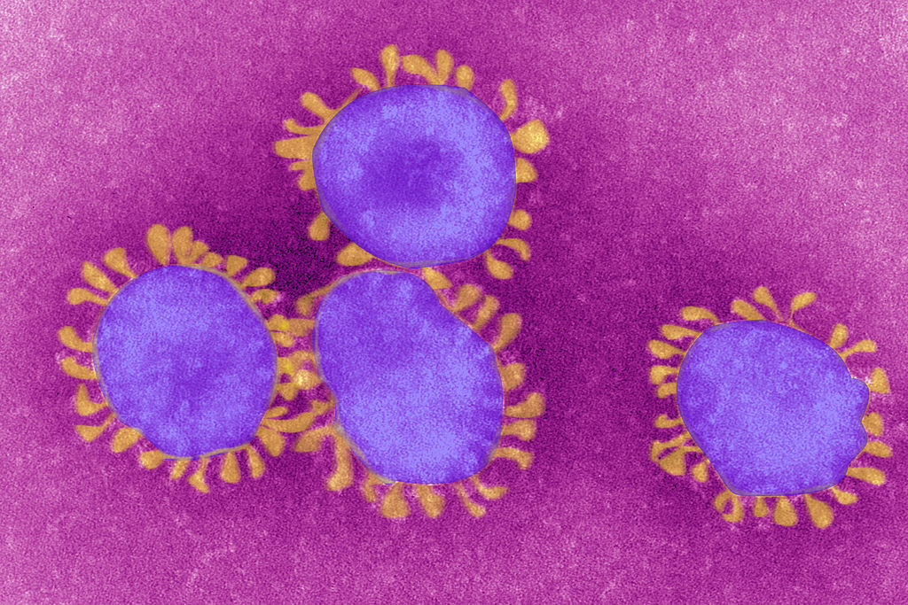 Coronavirus