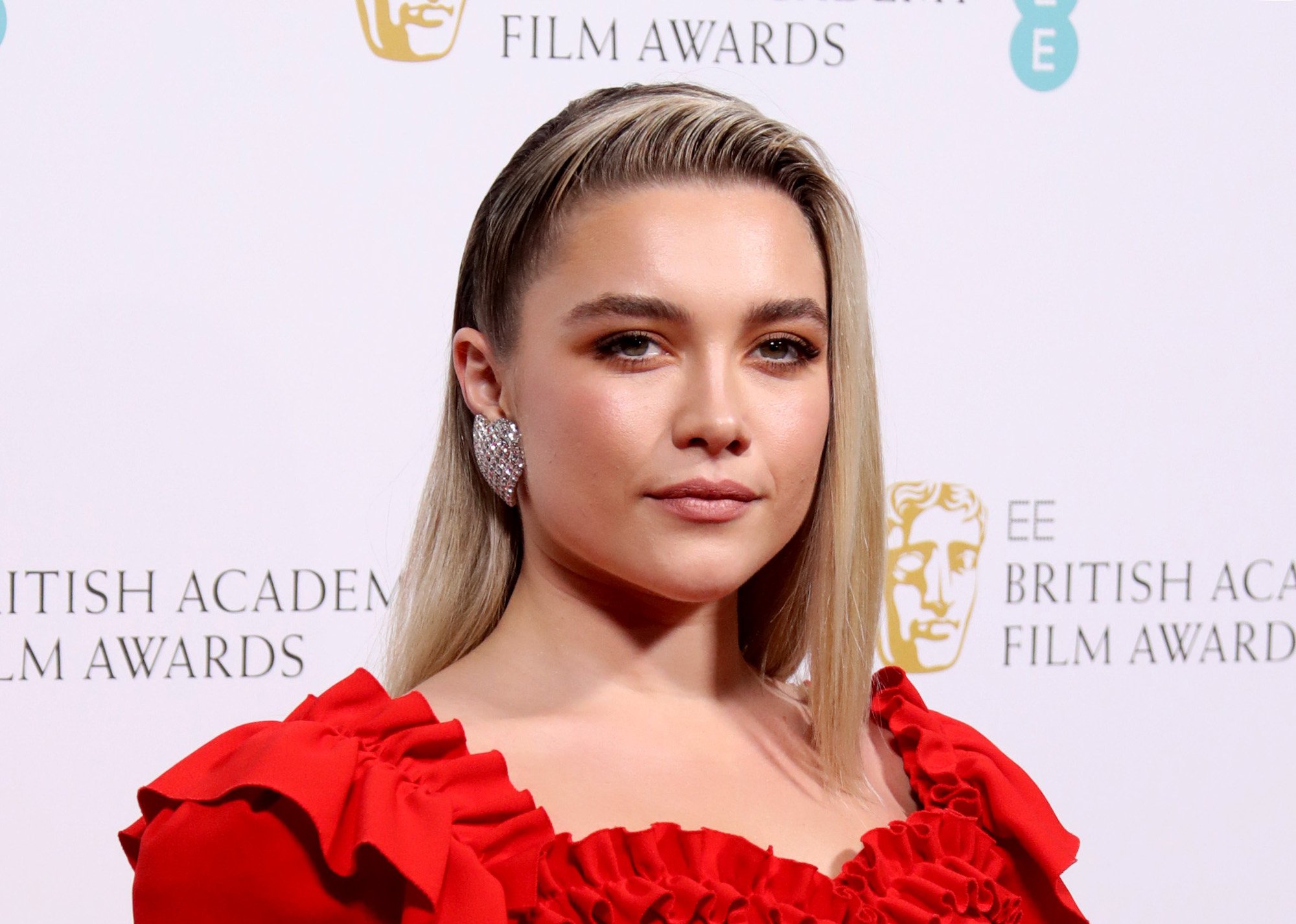 There’s a Medical Reason Florence Pugh Has a Distinct Voice, Especially When She Cries