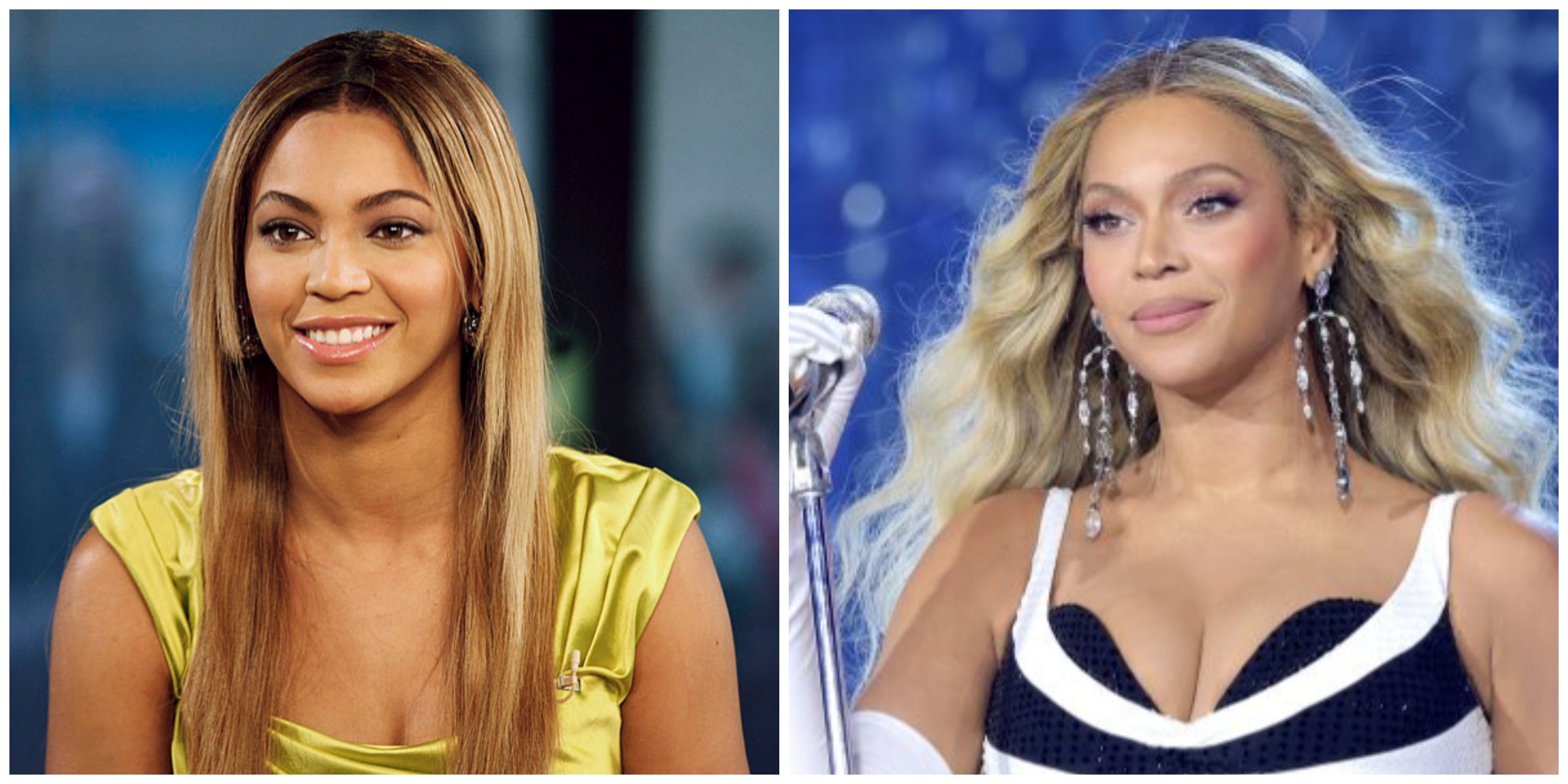 Beyoncé Plastic Surgery: Doc Says Singer Has Had Rhinoplasty and Breast ...