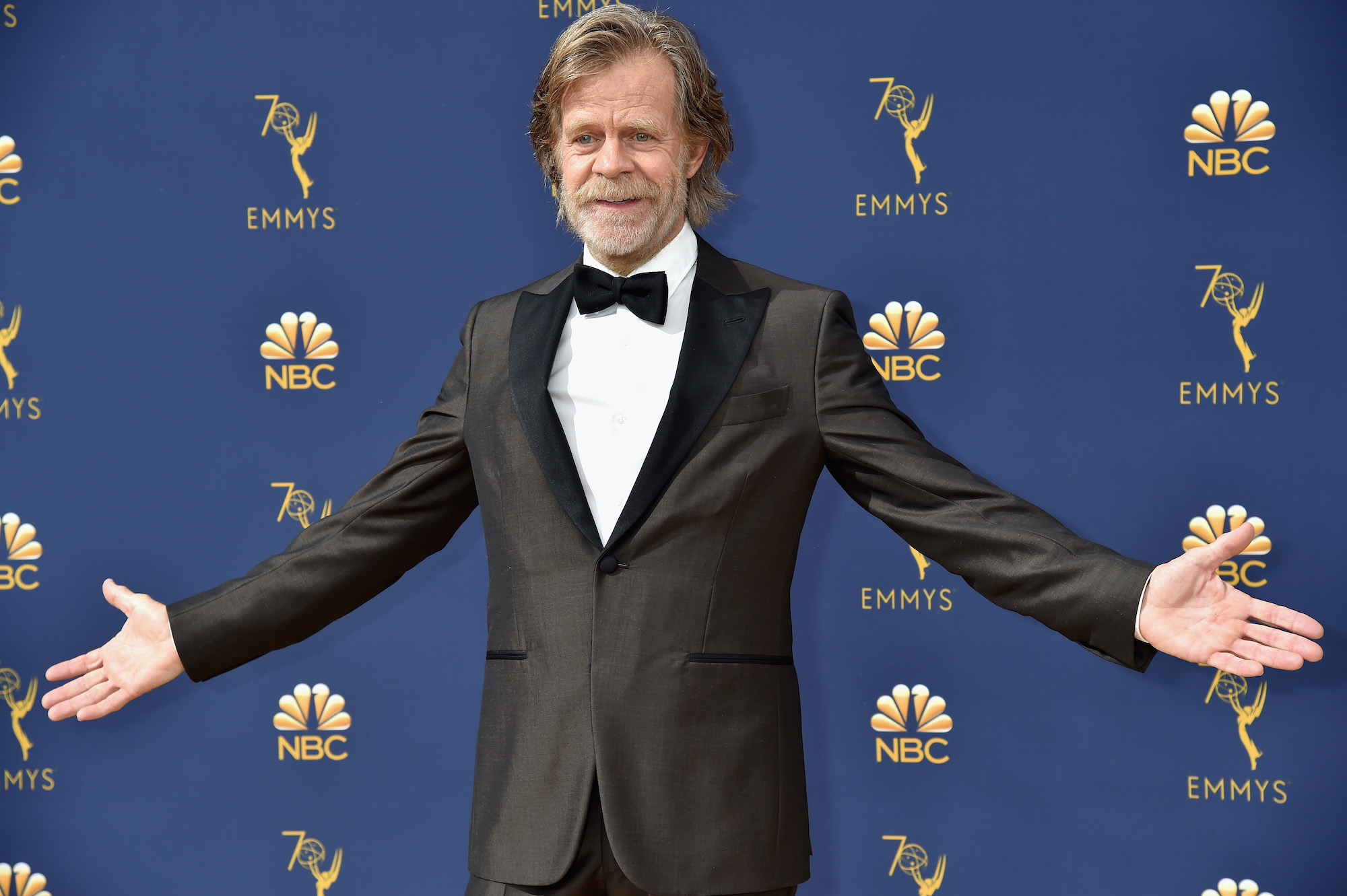 William H. Macy smiling, arms outstretched, in front of a blue background