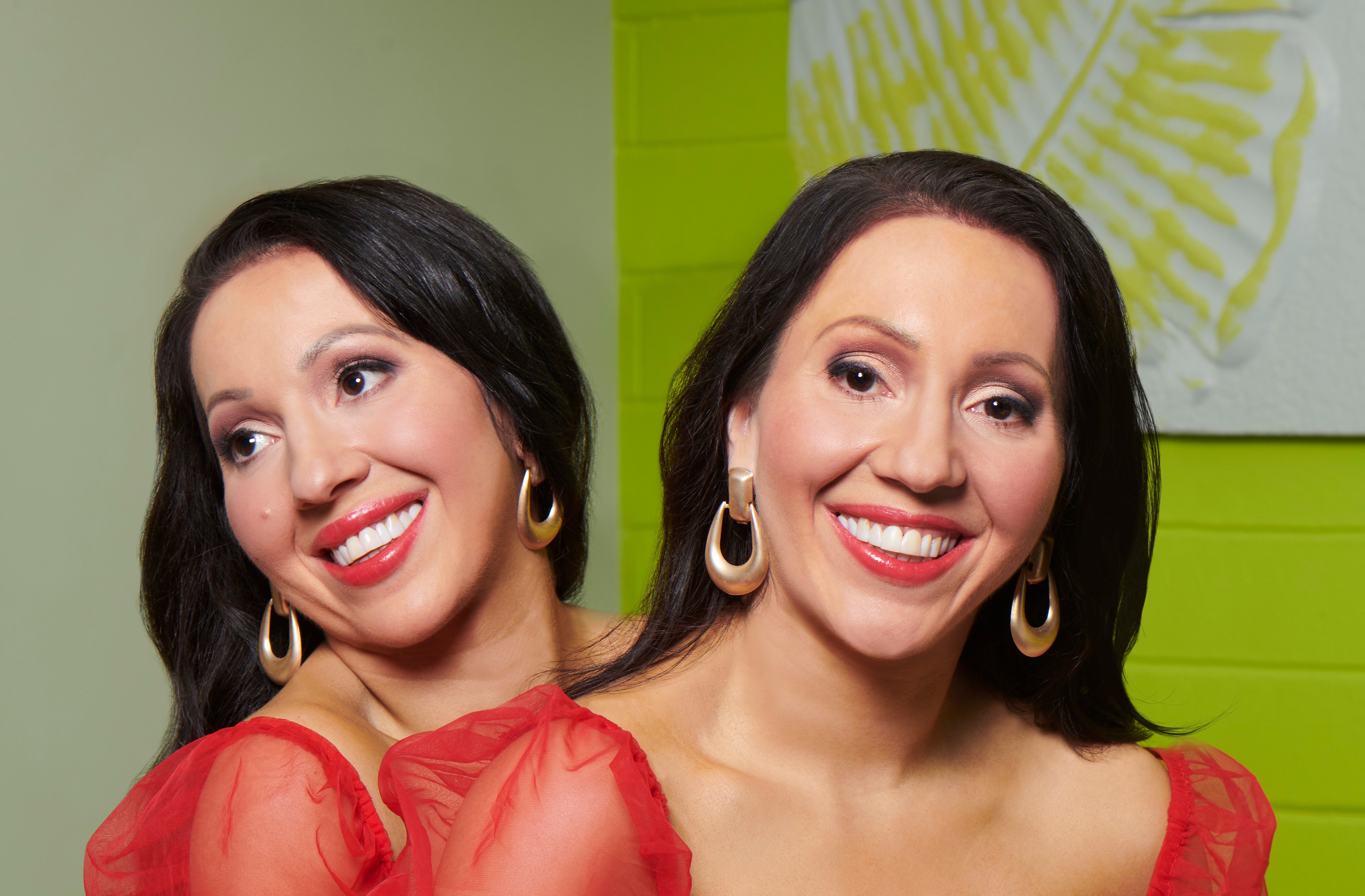Extreme Sisters': Who Are Anna and Lucy? They've Also Been on 'Botched'