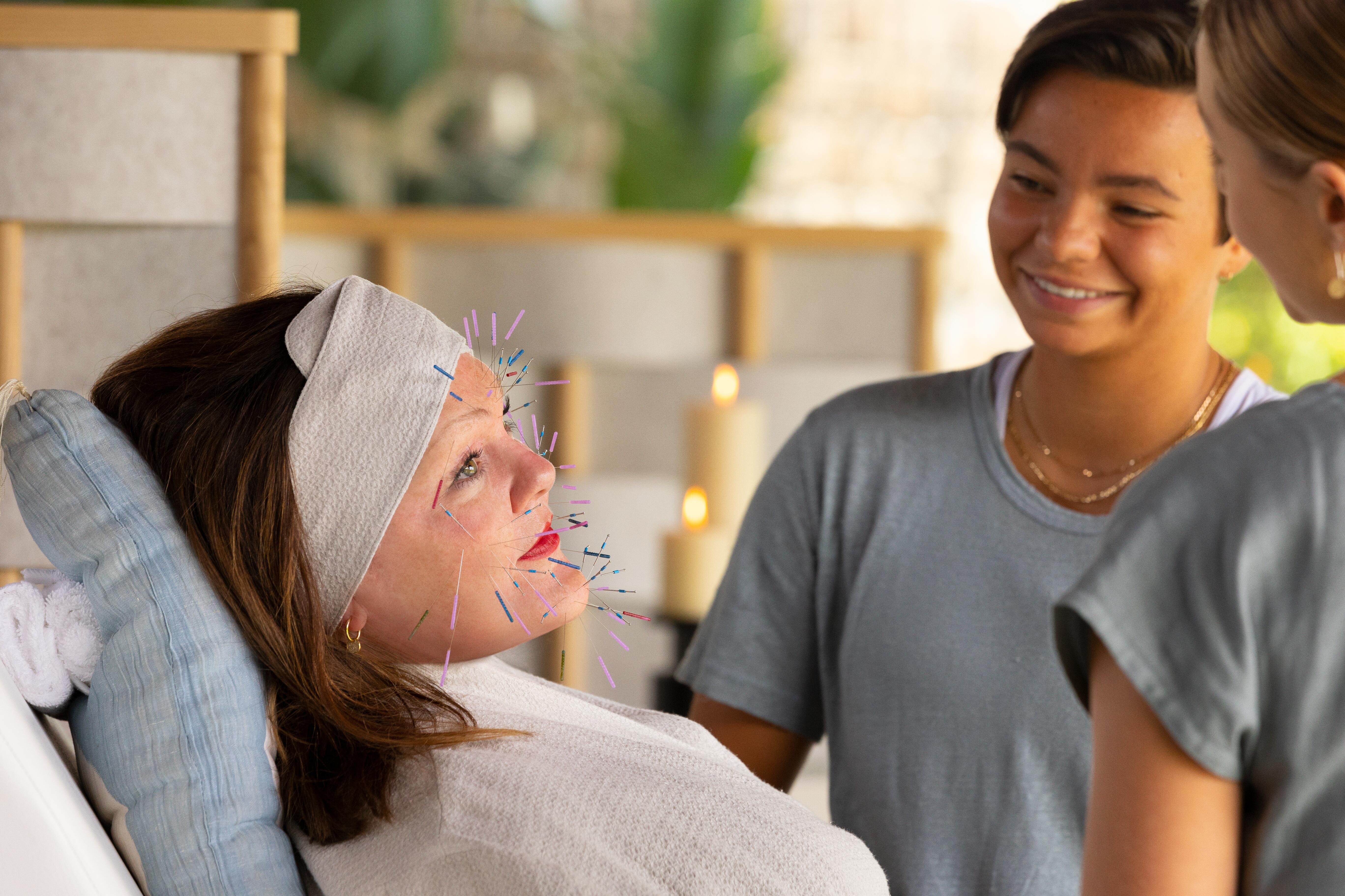 Frances Welty receives an acupuncture treatment in 'Nine Perfect Strangers.' She is smiling and wearing a white robe, and there are needles in her face. Two wellness consultants stand by her.