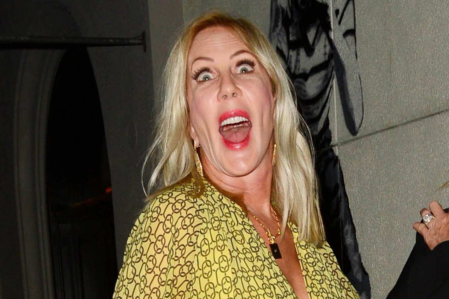 Vicki Gunvalson shocked