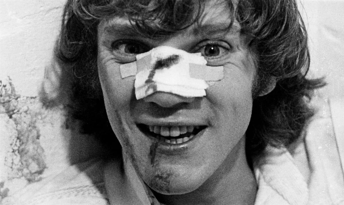A bloodied Malcolm McDowell films Clockwork Orange